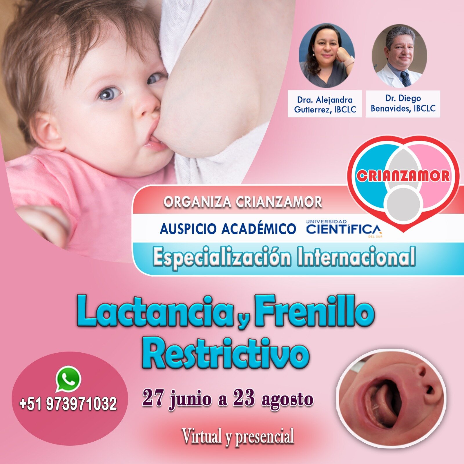 Especialización Internacional Lactancia en Frenillo Restrictivo